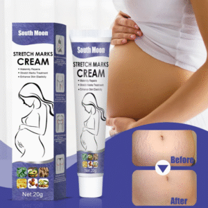 Stretch Marks Remover Cream
